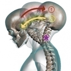 交通事故　むち打ち