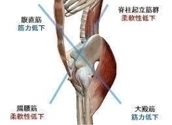 下位交差症候群!!