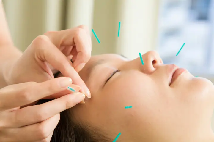 顎関節症で顔のゆがみが気になる方へ。美容鍼でケアする方法とは?
