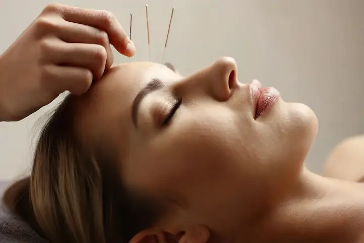 繰り返す大人ニキビに美容鍼！肌荒れの根本改善が期待できる理由
