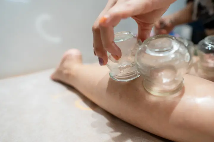 カッピングはデトックス効果がある？体の中で起こる変化をわかりやすく解説