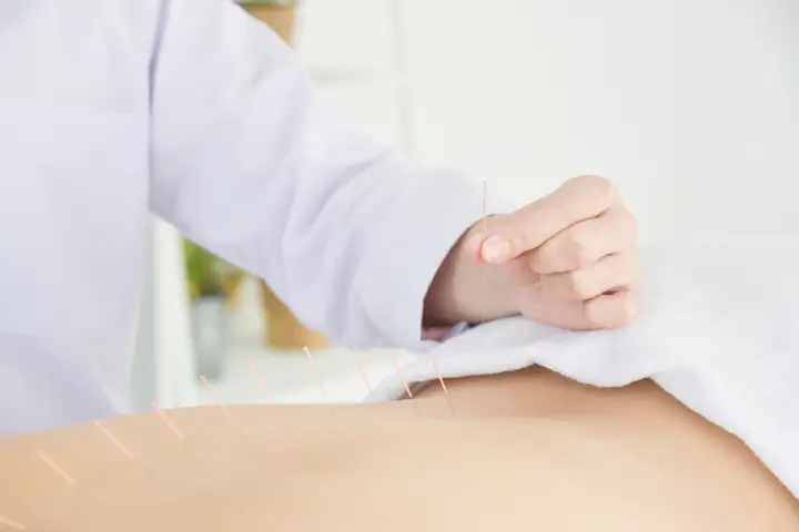 鍼治療で改善が期待できる代表的な腰痛の症状