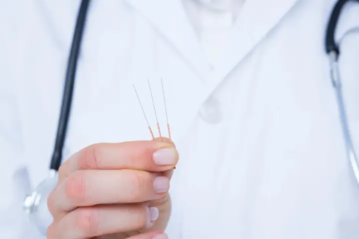 鍼は痛い?副作用は?初めての鍼治療に関する不安を解消
