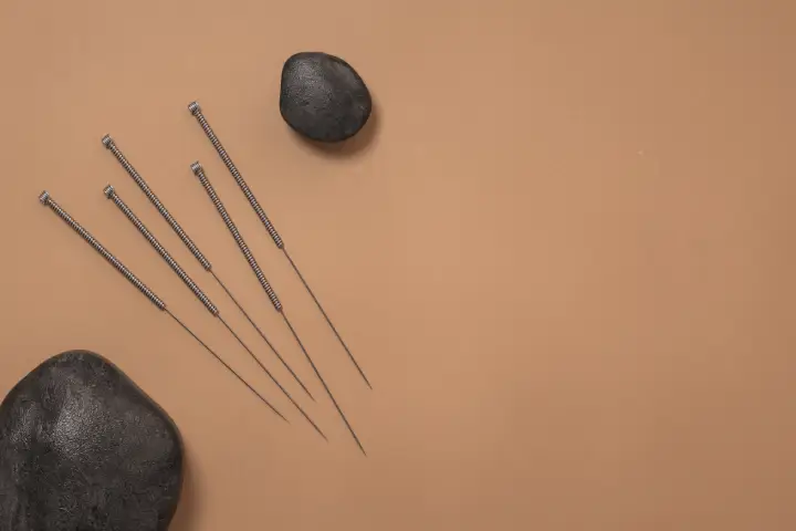 薬に頼りがちなその頭痛、鍼治療で根本改善を目指しませんか?