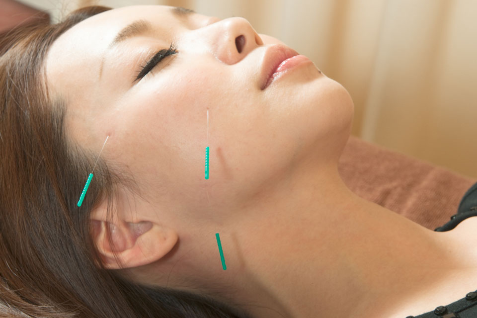 美容鍼の効果が定着するには、どれくらいの頻度がいいの?